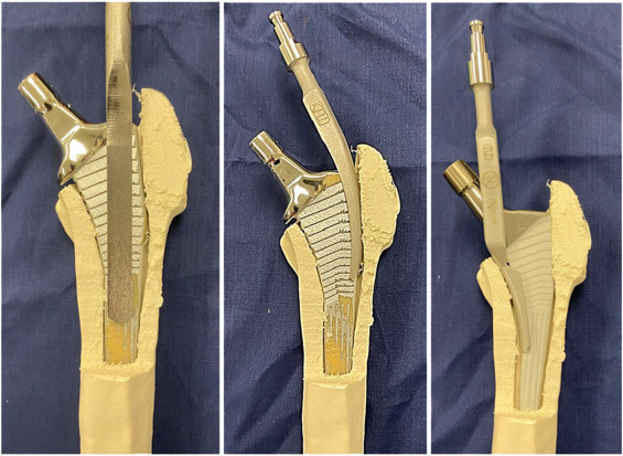 Model sequence showing inside-out anterior osteotomy for revision hip arthroplasty